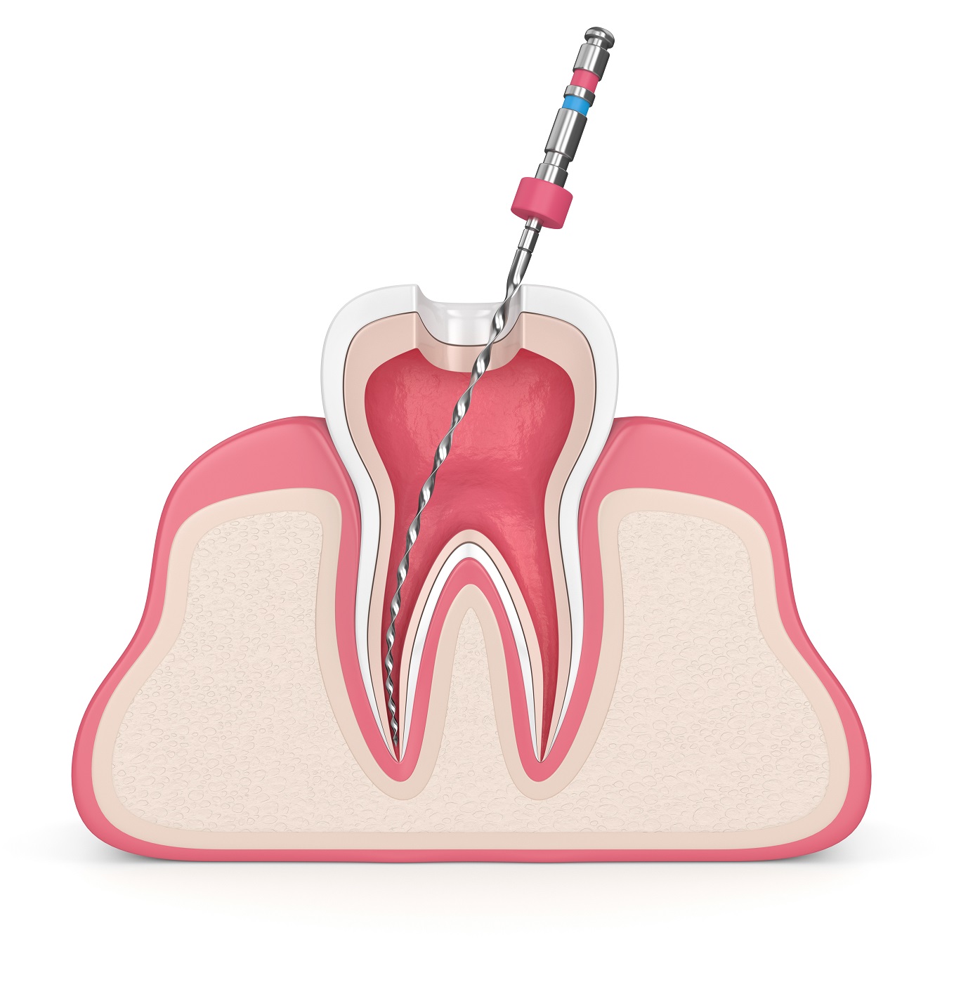 endodonzia